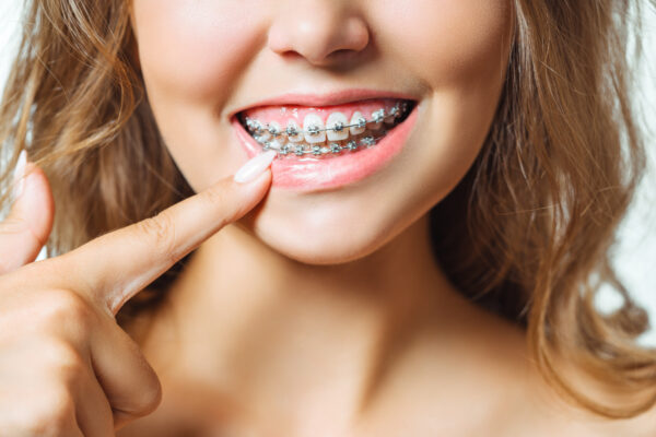 XALAPA-DENTISTA-SHDENTAL