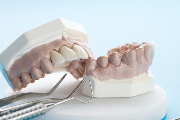 SHDENTAL-XALAPA-DENTISTA-CONSULTORIODENTAL
